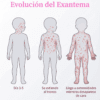 Proyecto “Nos informamos para prevenir ¡El Sarampión!” PRIMARIA NEM (2026-2027) 63 Vista previa 28 de Proyecto “Nos informamos para prevenir ¡El Sarampión!” PRIMARIA NEM (2026-2027)