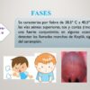 Proyecto “Nos informamos para prevenir ¡El Sarampión!” PRIMARIA NEM (2026-2027) 55 Vista previa 20 de Proyecto “Nos informamos para prevenir ¡El Sarampión!” PRIMARIA NEM (2026-2027)
