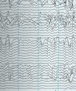 Un patrón abstracto de líneas horizontales onduladas que se asemejan a ondas sonoras aparece sobre un fondo blanco. El texto en la esquina inferior izquierda dice "PPT Física Ondas y Sonido" con "Martín Vivar" debajo, insinuando sutilmente conceptos de Física.